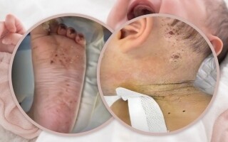 Mother stabbed her 10-month-old baby hundreds of times with needles