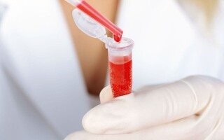 Blood Type B Linked to Higher Diabetes Risk