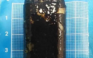 Doctors Successfully Remove Lighter from Man's Stomach 40 Years After He Swallowed It